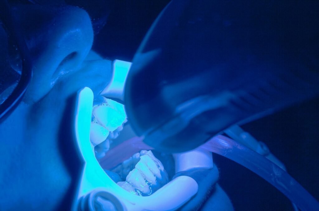 teeth whitening