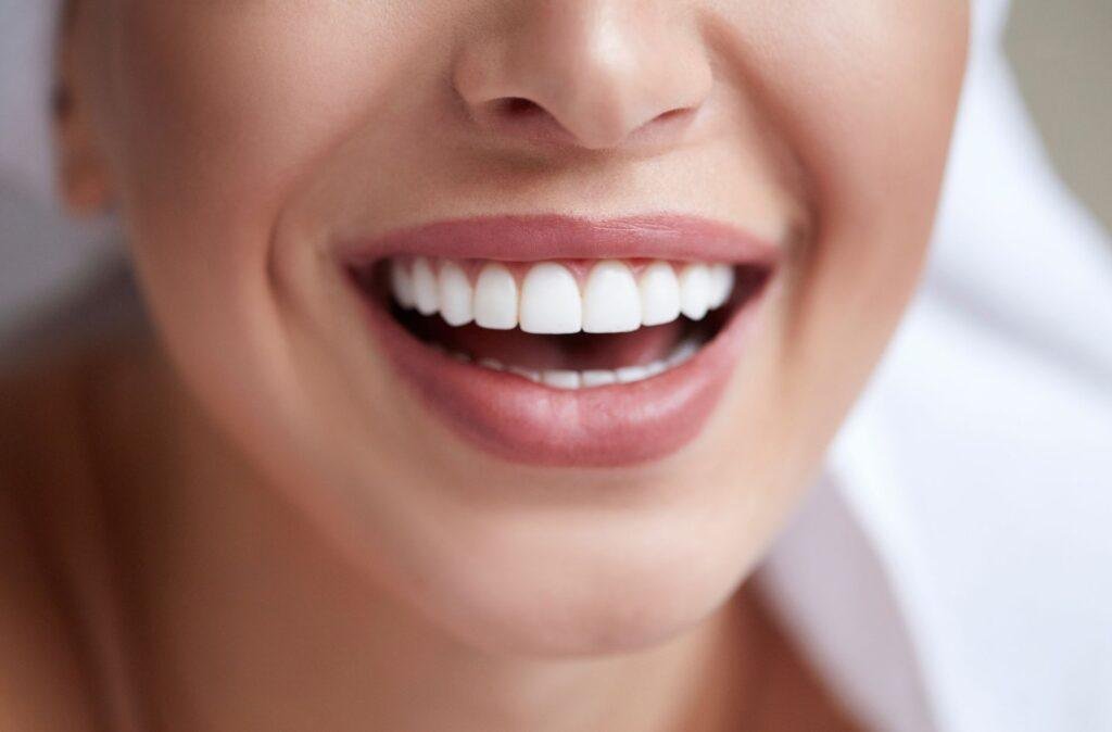 teeth whitening