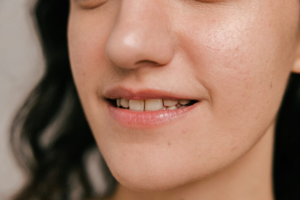 crooked teeth