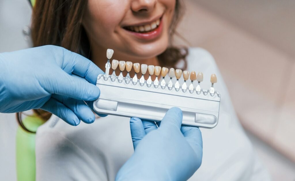 veneers
