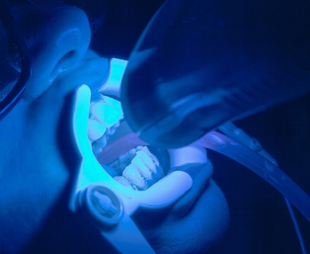 teeth whitening