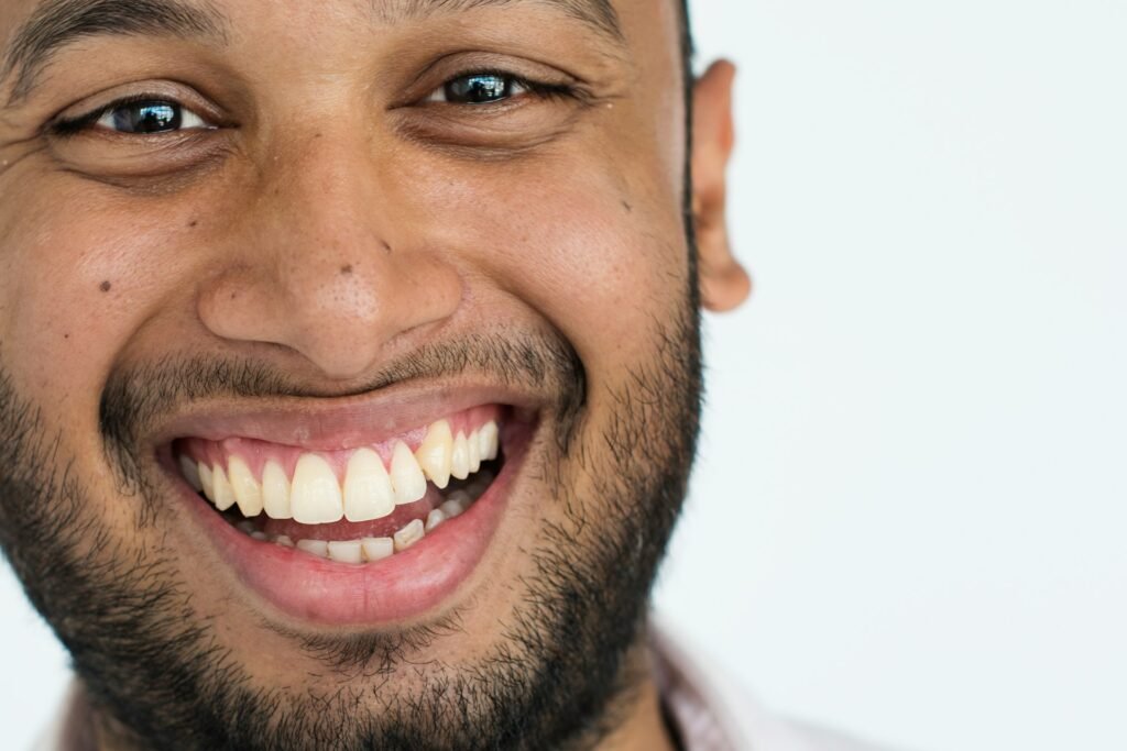smile makeover