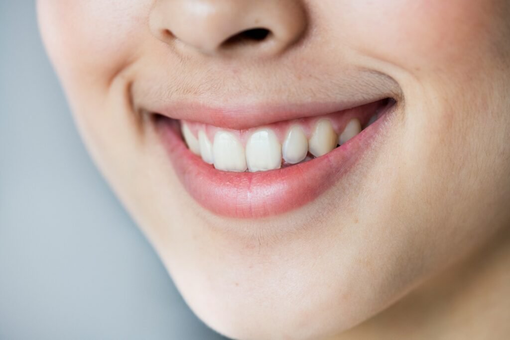 dental implants