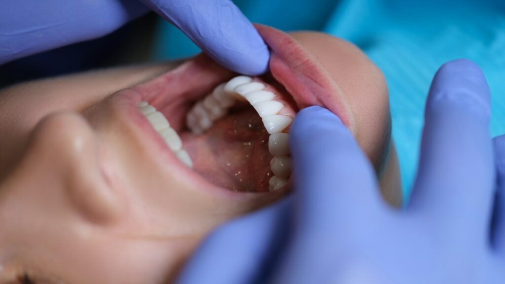 teeth whitening