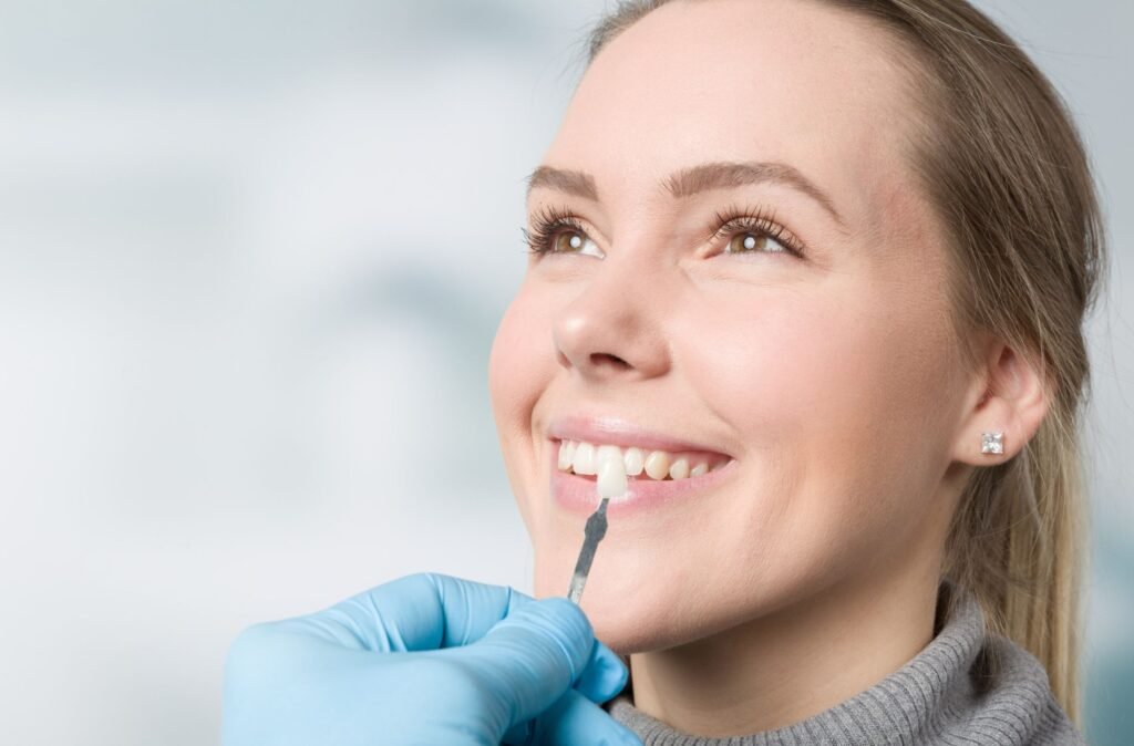 veneers