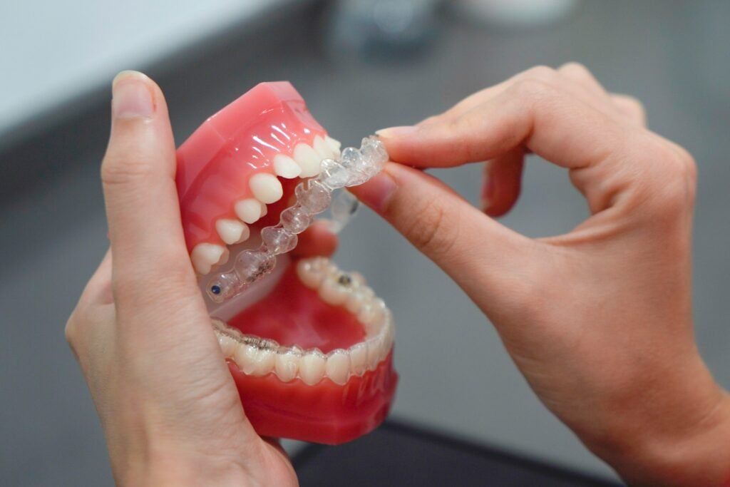 Invisible Braces