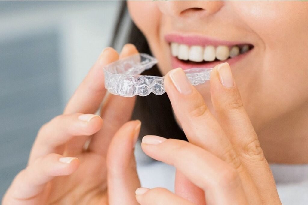 clear aligners