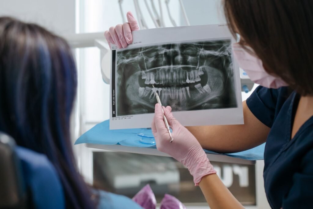 Full Mouth Dental Implant