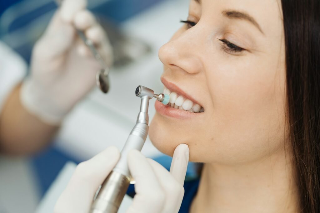 dental veneers