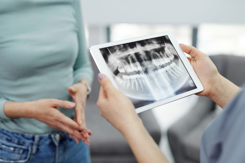 Dental Implants