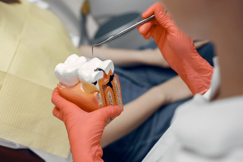 Tooth Decay