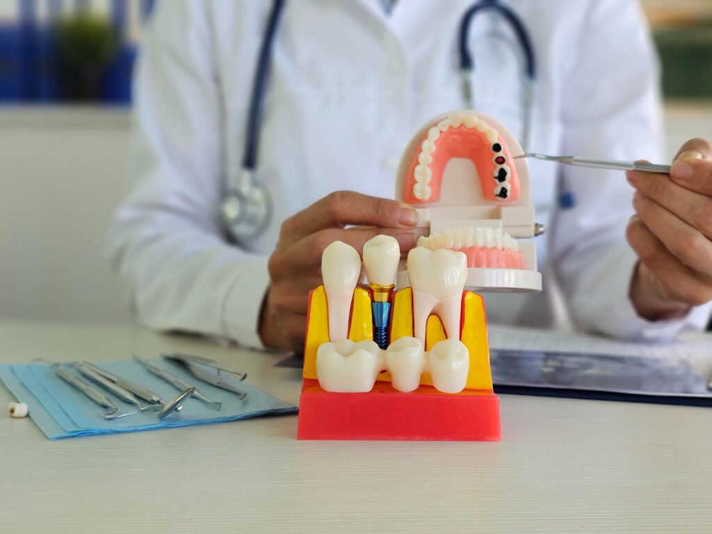 Dental Implants