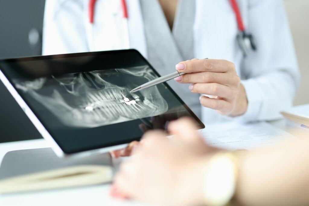 Dental Implants